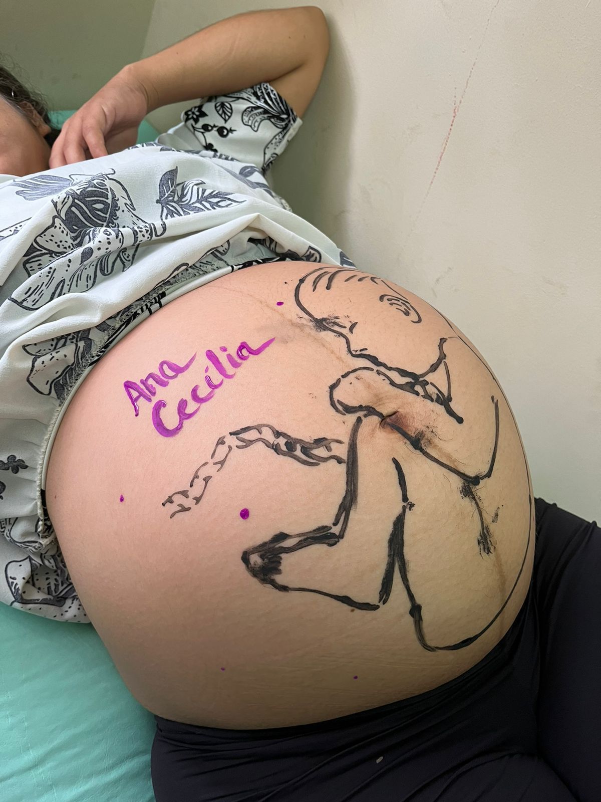 Petrolina é destaque no 5º Fórum Perinatal da VIII região de Pernambuco